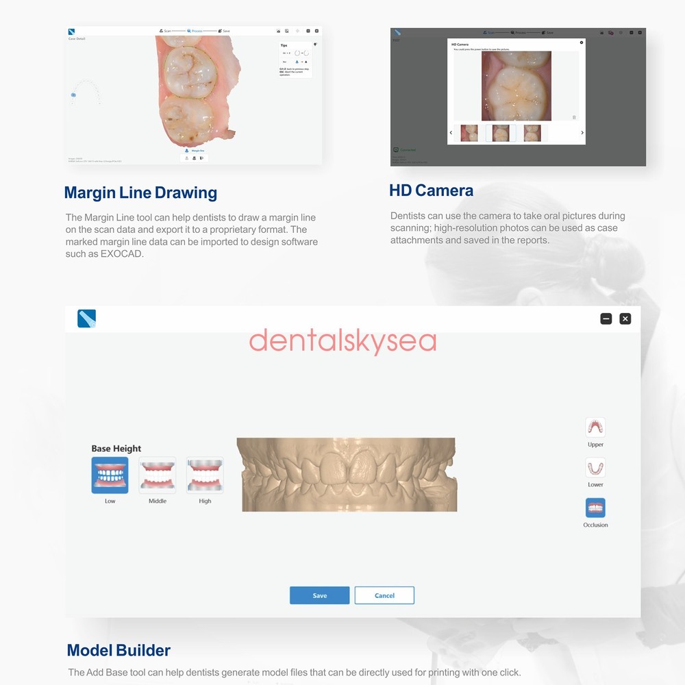 Dental Digital Impression Intraoral 3D Scanner Scanning Software CAD/CAM Process