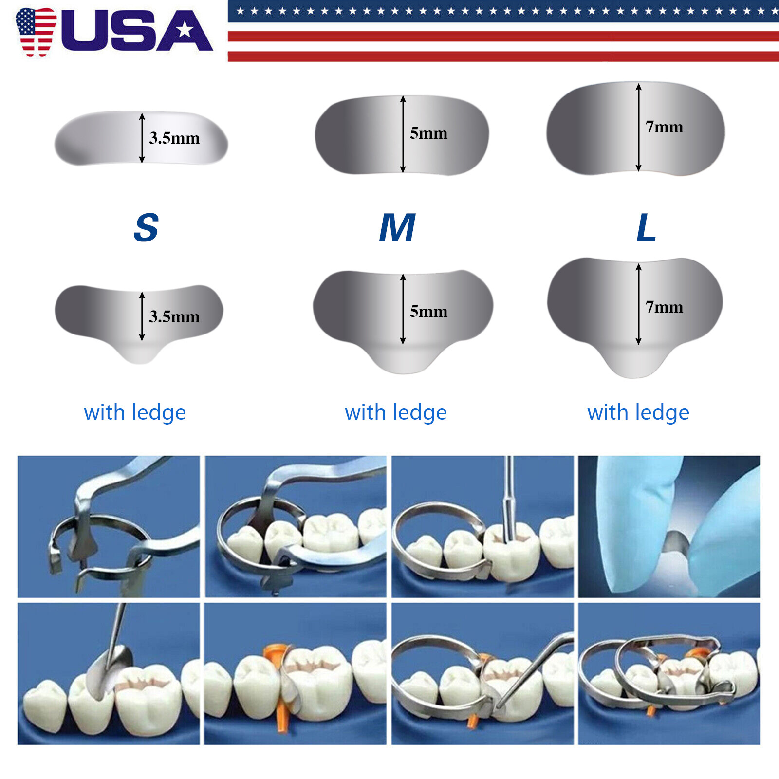 Dental Sectional Matrix System Contoured Metal Matrices Refill Matrix Bands 50x