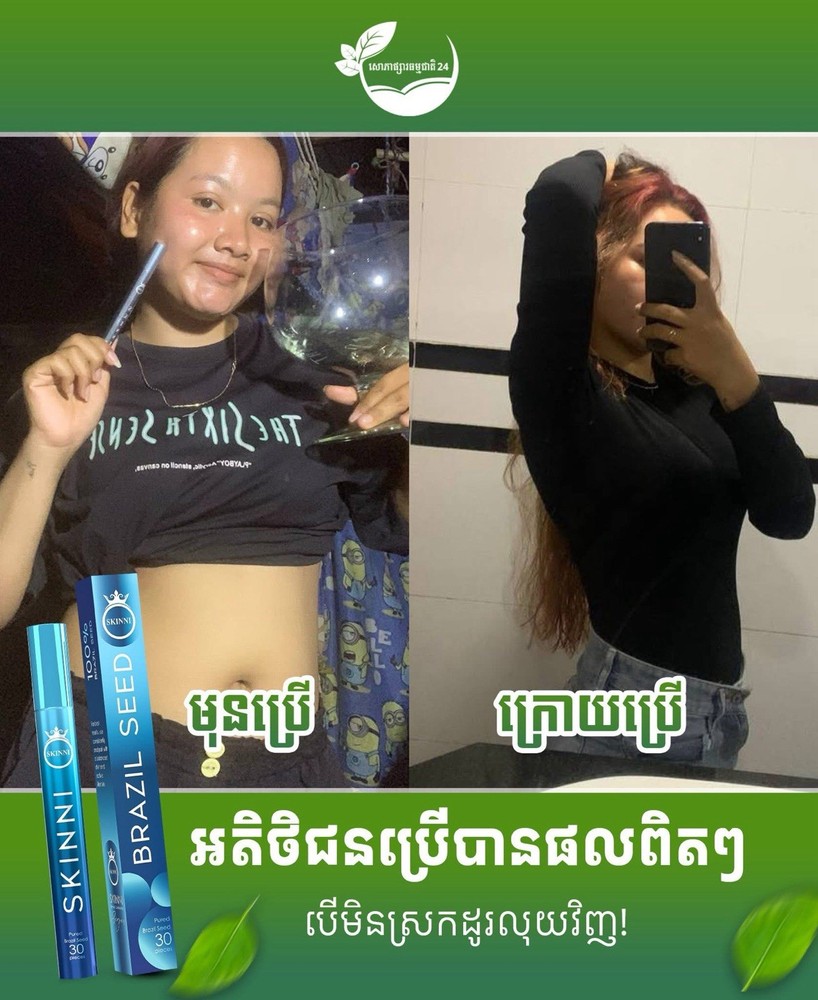 SKINNI Fast Slimគ្រាប់សម្រកធម្មជាតិ ស្គីននី1ប្រអប់( 1ប្រអប់/ 30គ្រាប់ )