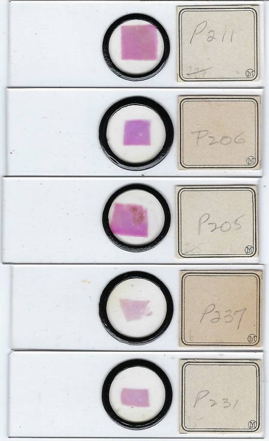 Human Unknown Pathology Microscope Slides by Moeller (A)