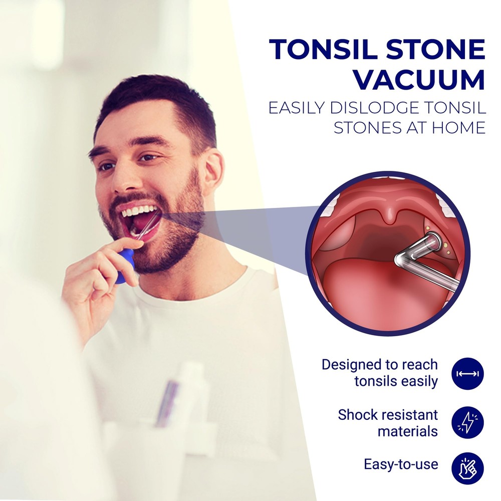 Tonsil Stone Remover Vacuum - Easy Suction Tool for Tonsil Stone Extraction