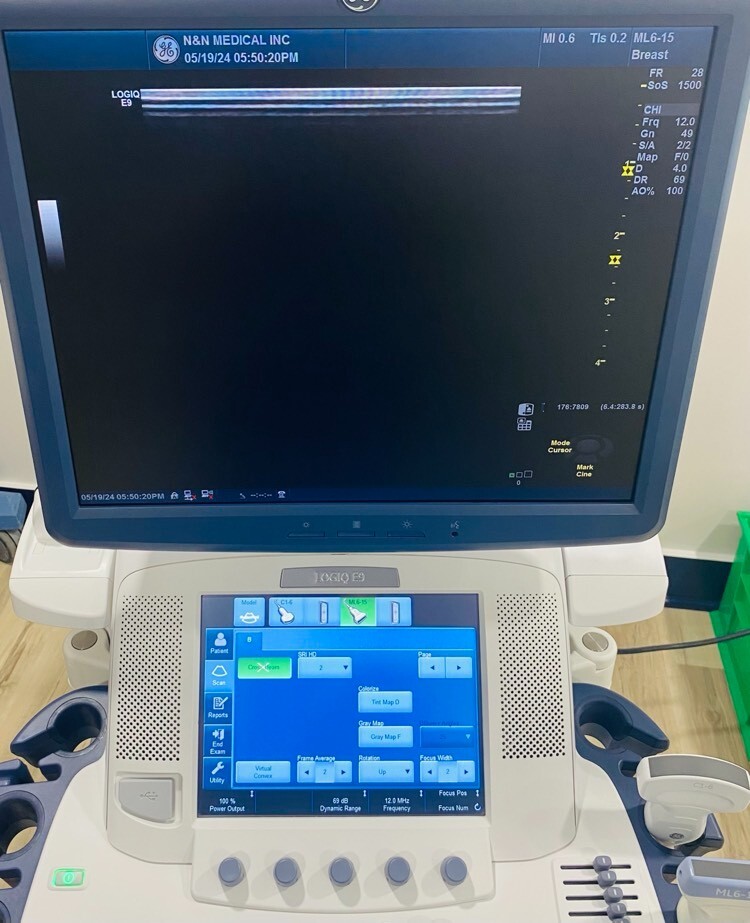 GE Logiq E9 Ultrasound System [DOM:2012]