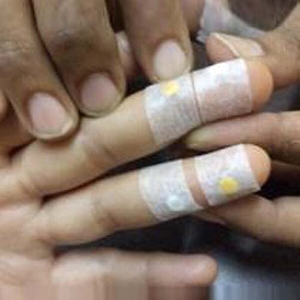 Acupressure Sujok Byol Magnet Medium 5mm (60pc)