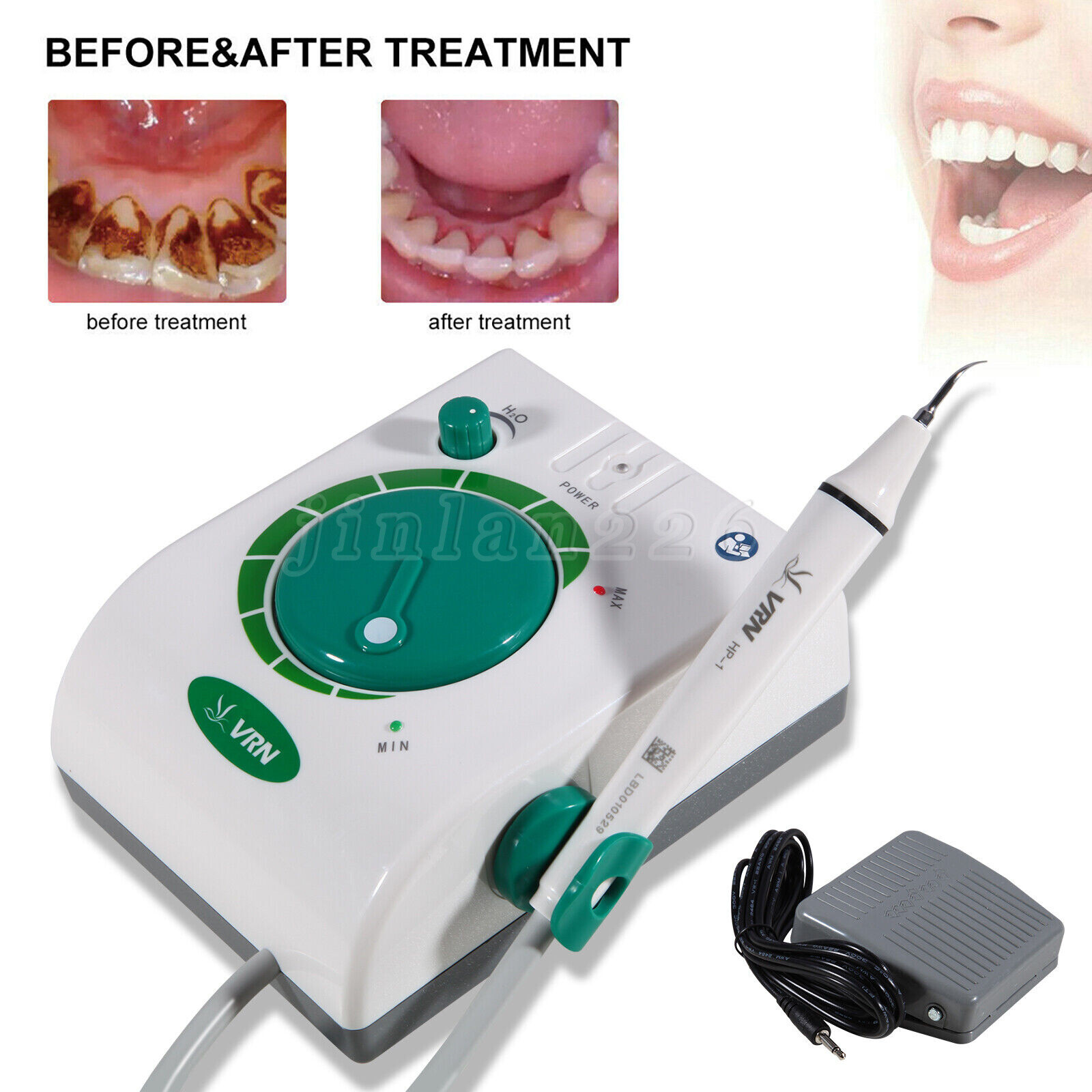 Dental Ultrasonic Scaler Piezo Scaling Handpiece Cleaning fit EMS Woodpecker USA