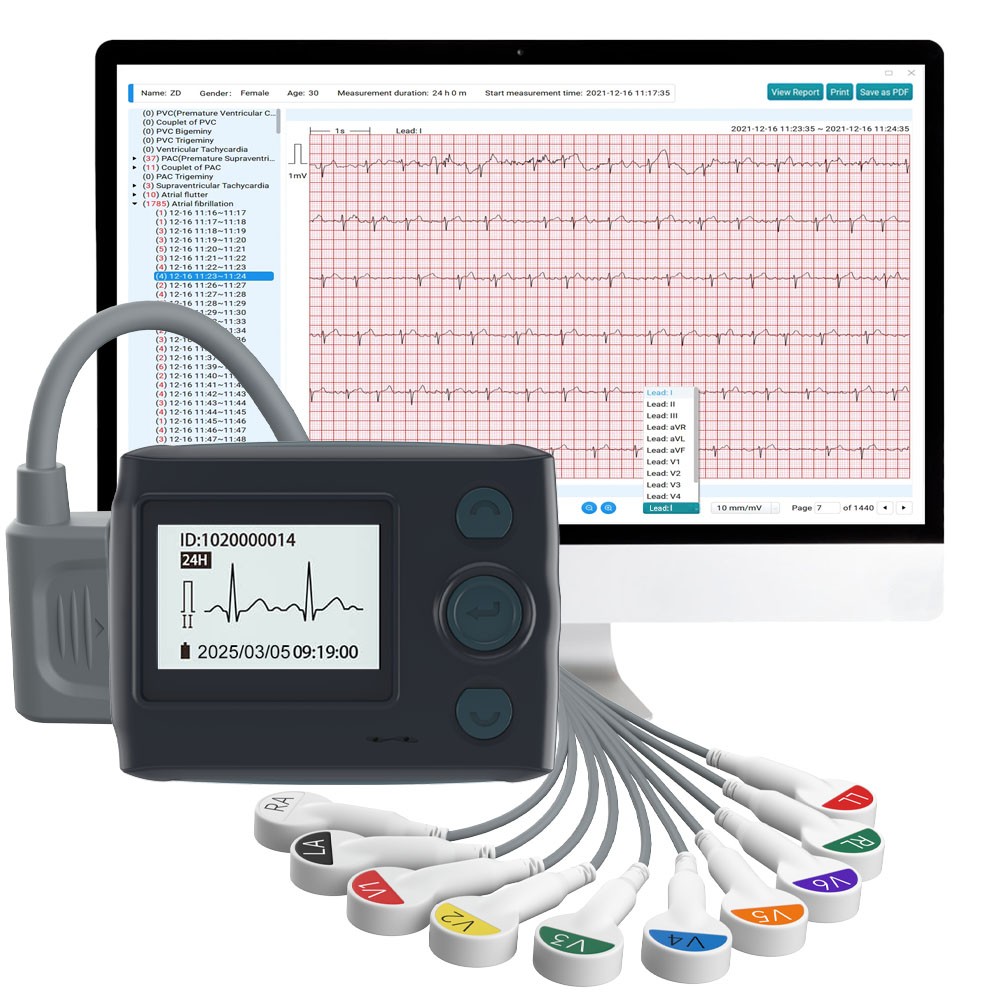 12 lead Holter Monitor 24h Portable with AI analysis software for Mac & Windows
