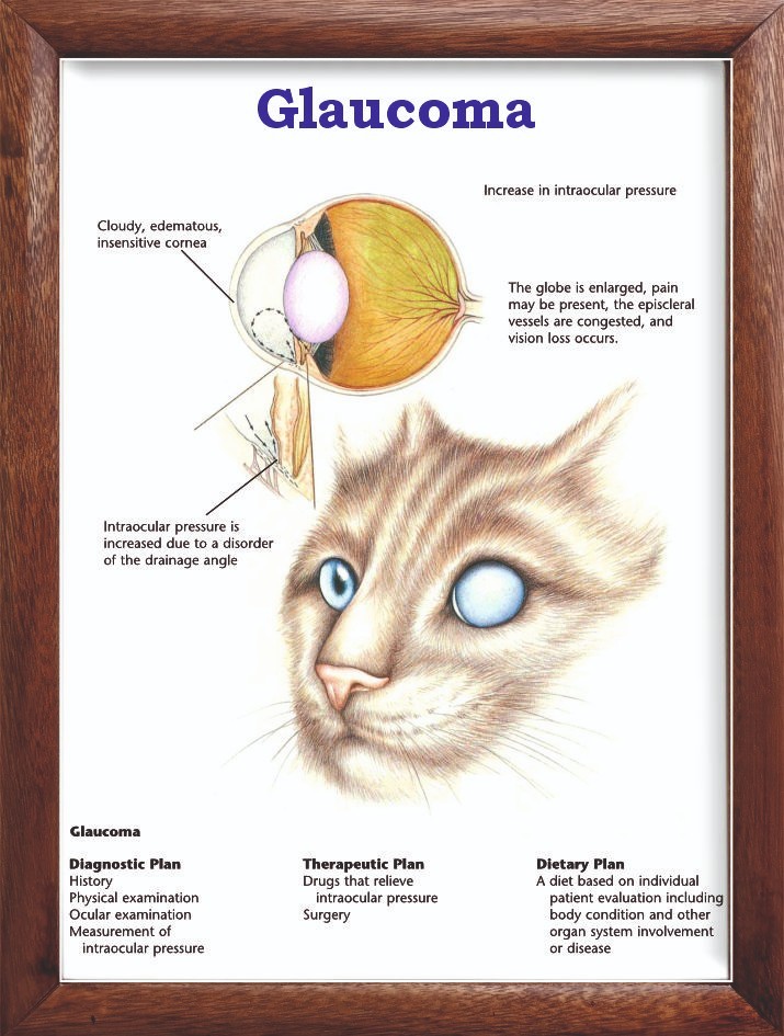 Glaucoma Chart 12x18 inches