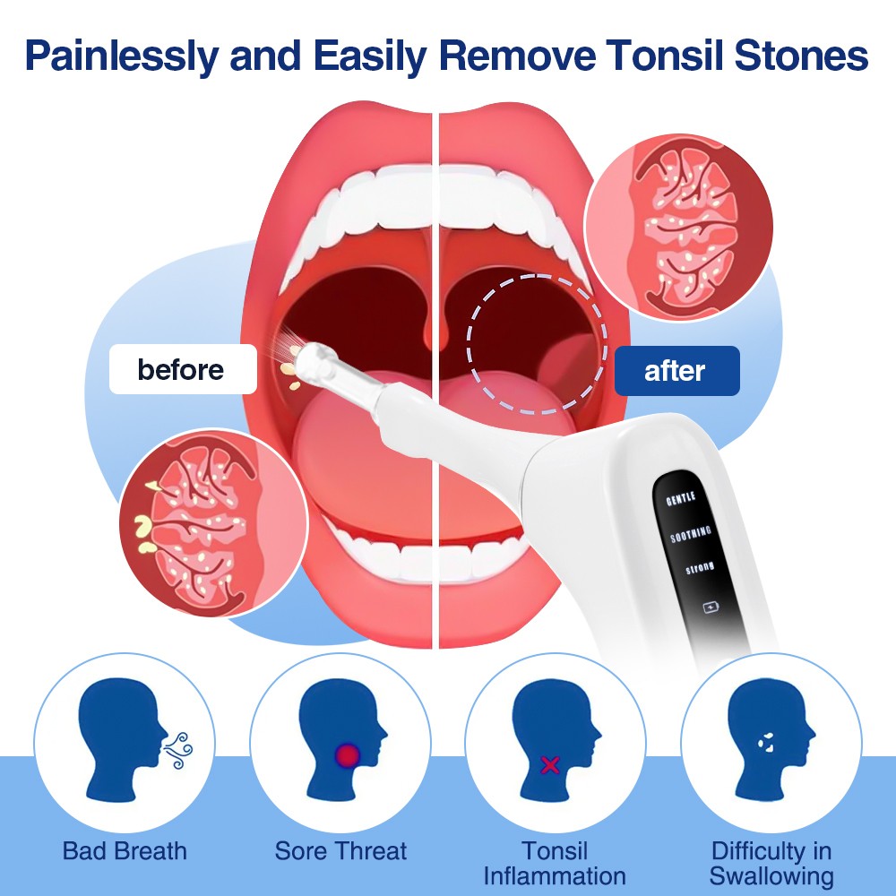 Electronic Vacuum Tonsil Stone Remover Kit LED Light 3 Mode Tonsil Stone Cleaner