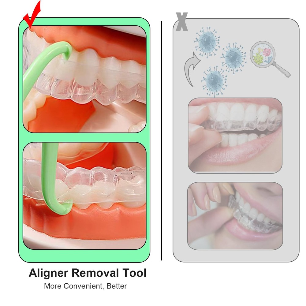 Aligner Removal Tool, Portable Clear Tool for Invisalign 8PCS