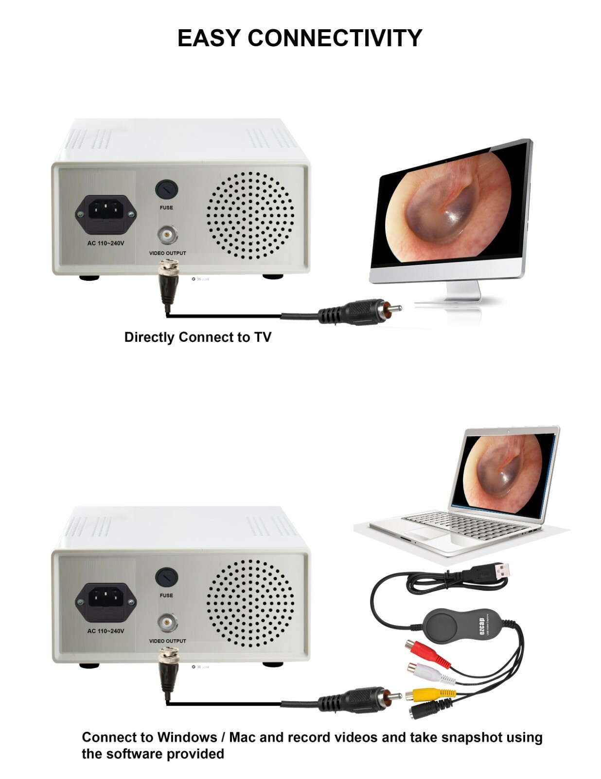 Portable Endoscopy Camera & Cold LED Light Source HD USB ENT Medical Endoscope