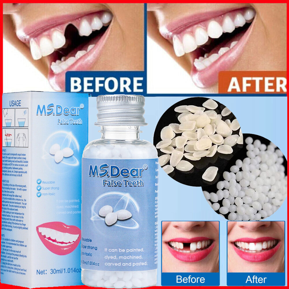 Dental Cement Strong Teeth / Tooth Repair Temporary Dental luting Cavity Filling