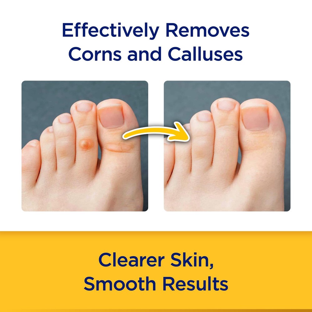 CornStick Maximum Strength Salicylic Acid Solid-Stick Corn and Callus Remover