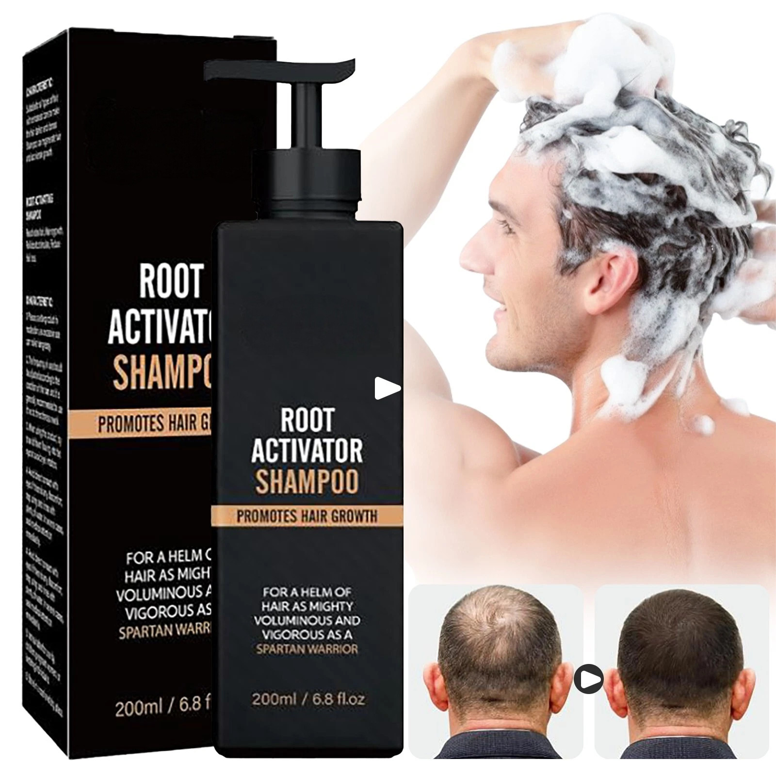 New Root Activator Shampoo SPARTAN Hair Loss Shampoo Root Activator ( 200ml )