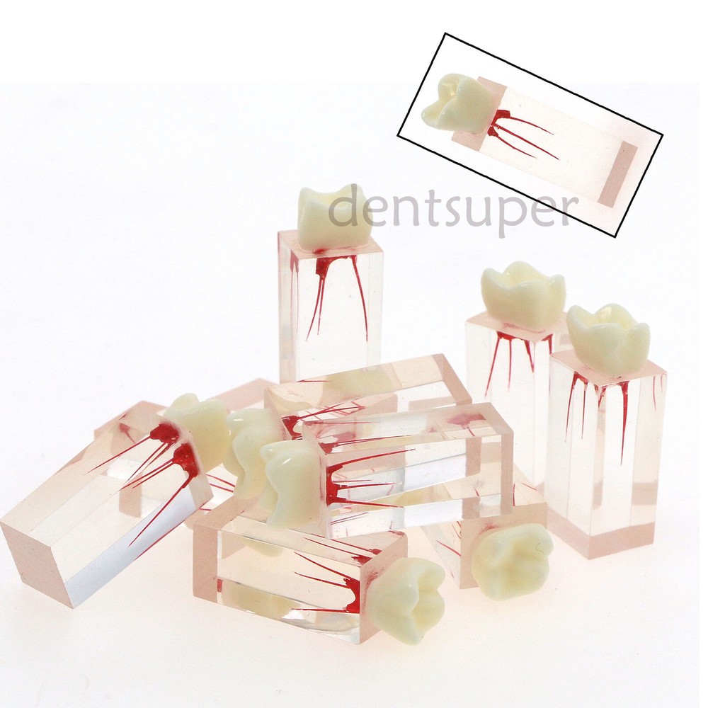 Dental Endo Root Canal Teeth Model Study Practice Block RCT Pulp Cavity
