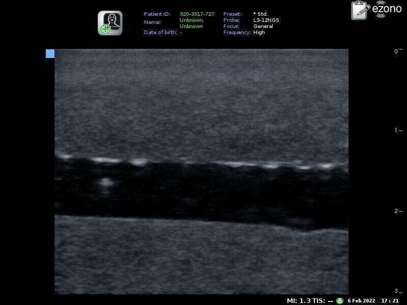 4 set simple ultrasound phantom training model-nerve and vessel