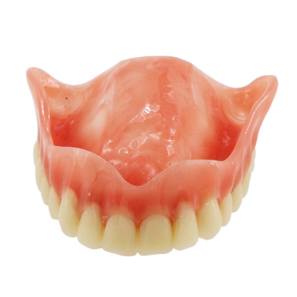 Dental Teeth Model Overdenture Removable Teeth Upper/Lower Jaw 4 Implants Model