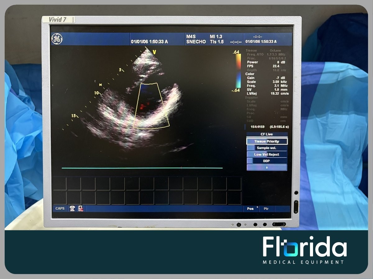 2013 GE M4S SECTOR ARRAY ULTRASOUND TRANSDUCER PROBE REF: 5129041 TESTED