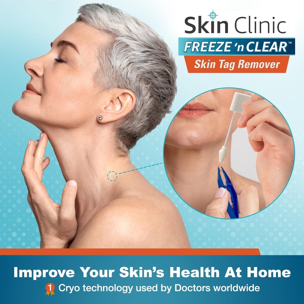 Effortless Skin Tag Treatment Kit - 8 Precision Tips, -Cleared Solution