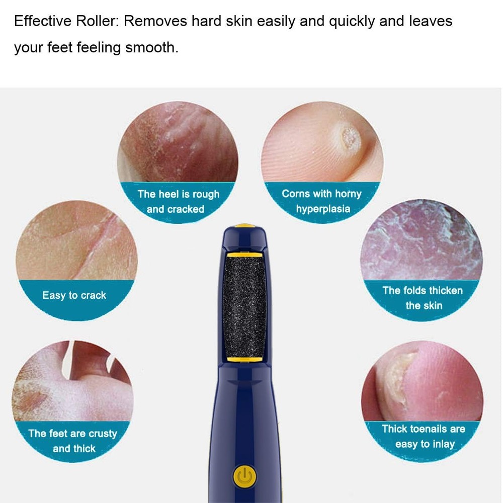 Replacement Roller Compatible with Dr. Scholl's Callus Remover Electronic Foo...