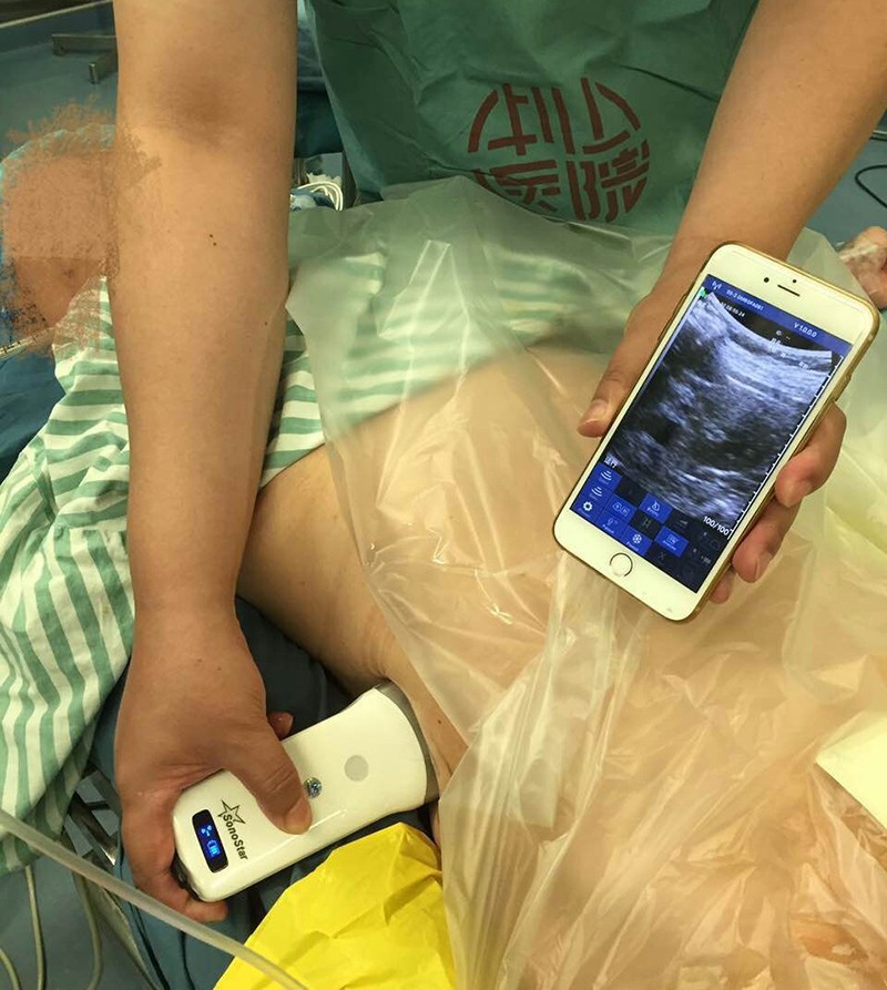 Wireless Ultrasound Probe Scanner Portable Machine Support iOS Android Windows