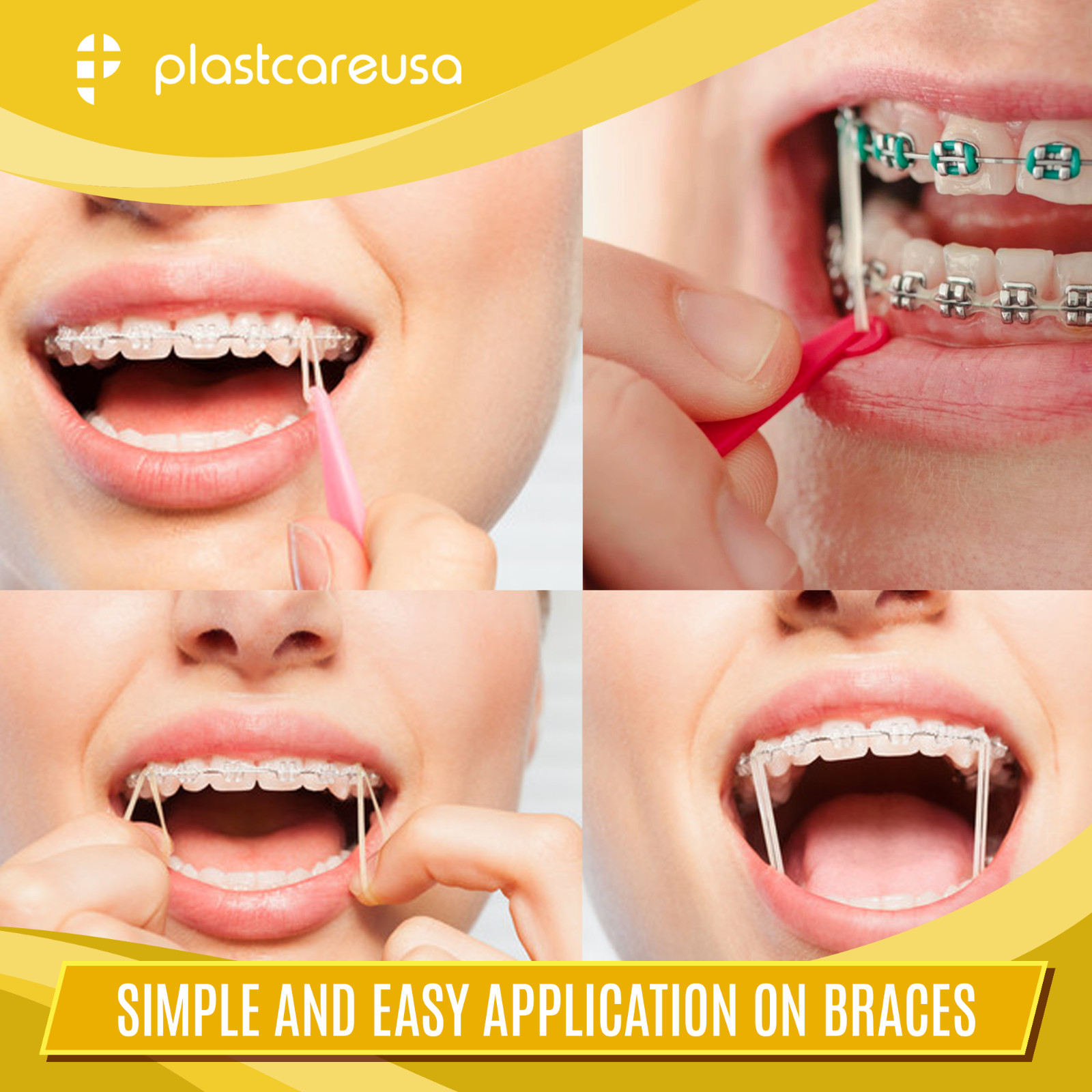 100 Medium 4.5 Oz 1/4" Fox Orthodontic Latex Elastic Rubber Bands Braces