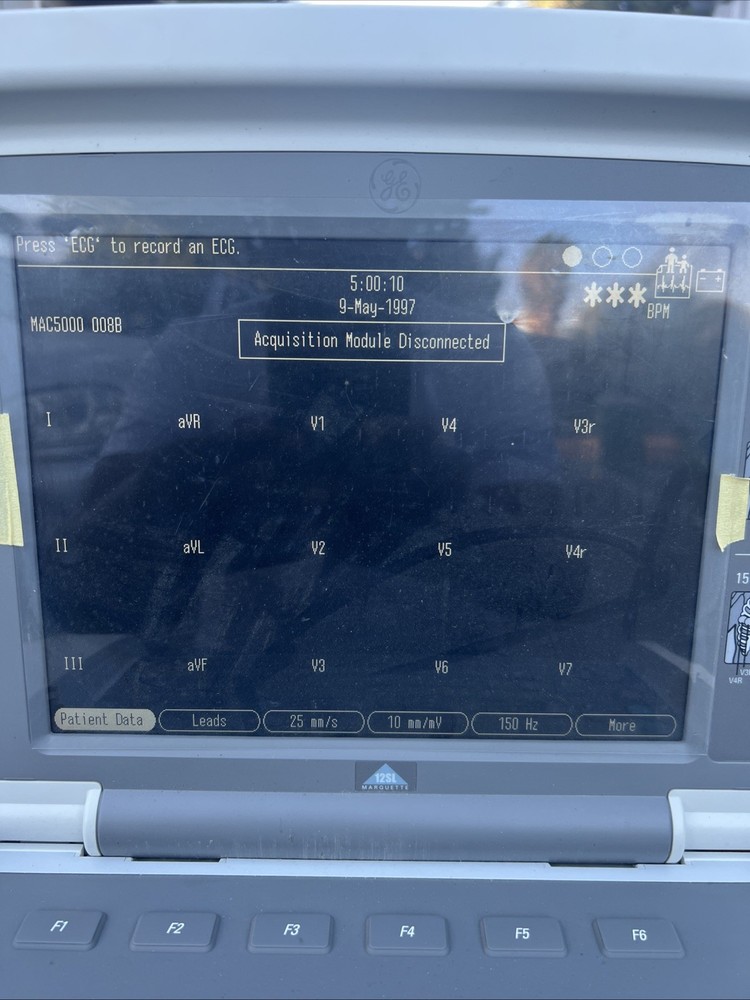 GE Mac 5000 Powers On Sold As Is