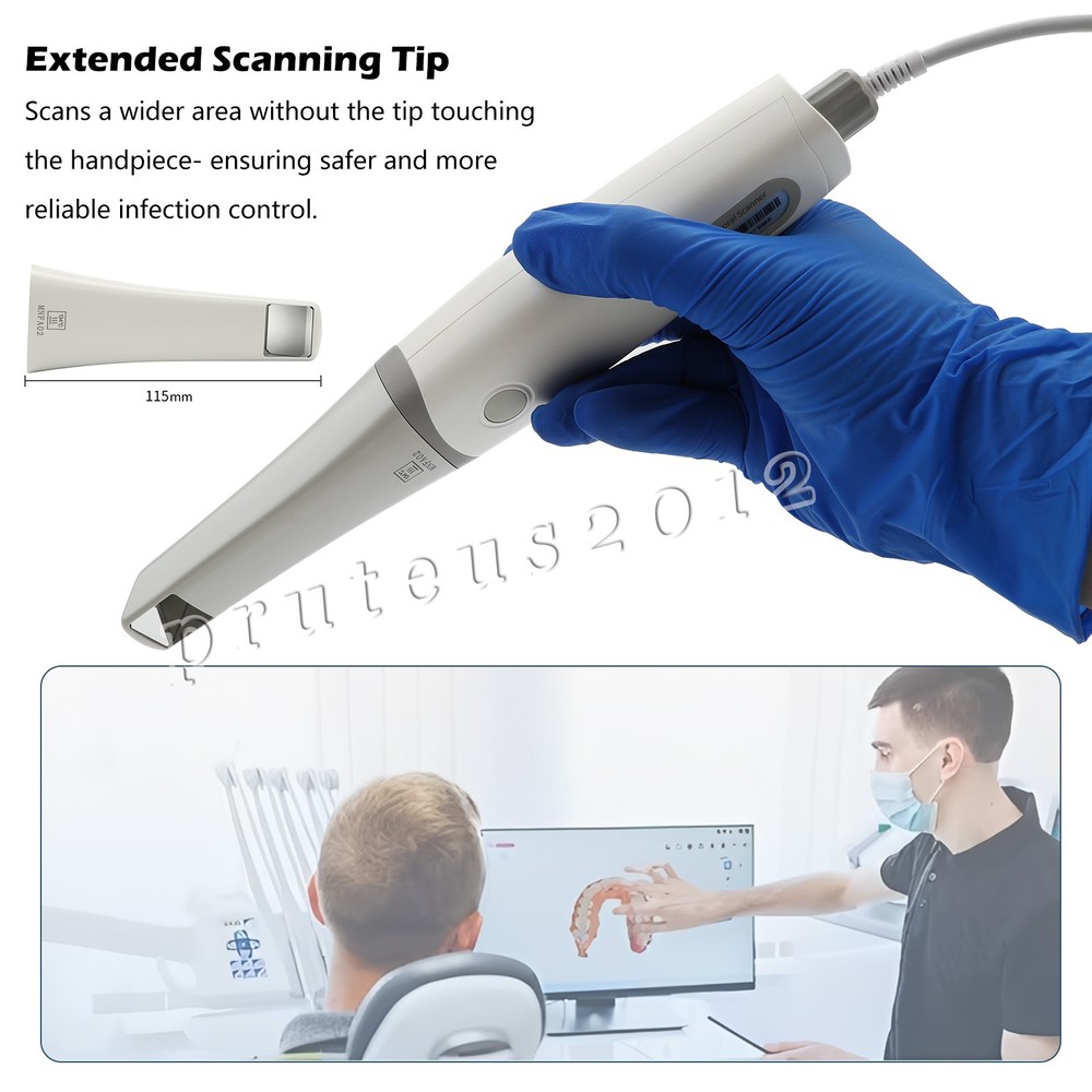 IntraOral Scanner - Digital Dental Solutions