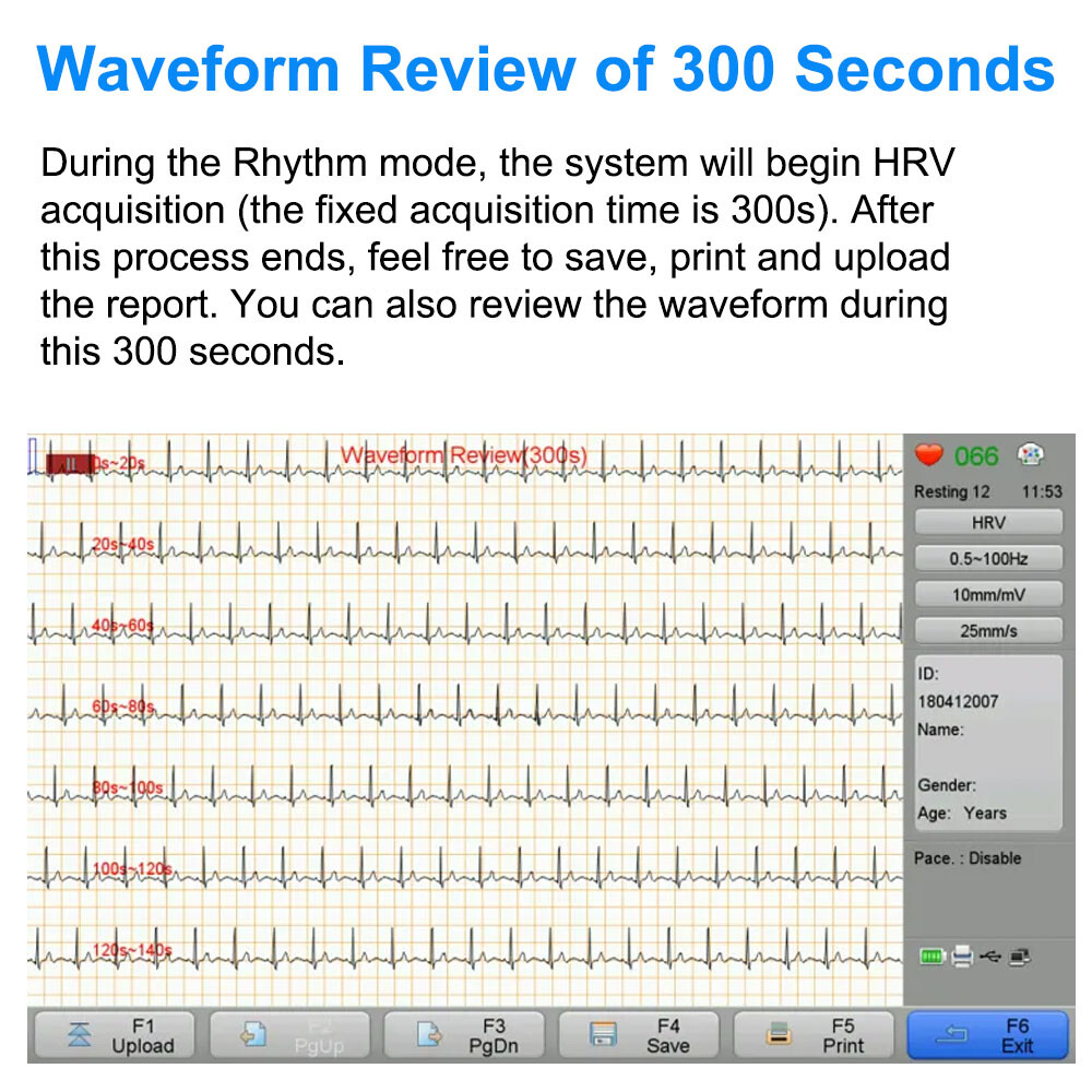 Biocare 12 lead ECG Machine Portable with Au-to Analysis Diagnosis ECG, Printer