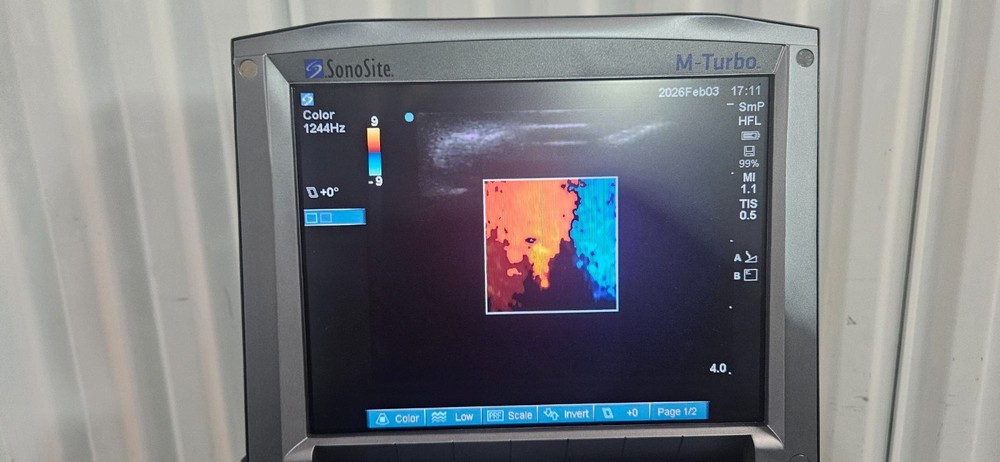 SonoSite M-Turbo Ultrasound