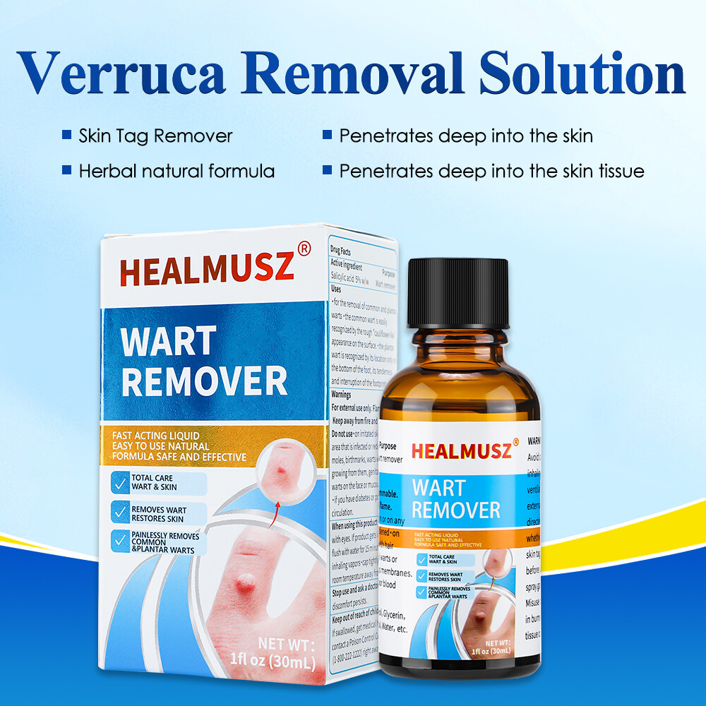 Wart Remover Liquid Skin Tag Mole Remover Eliminate Feet Corn Wart Remove Liquid