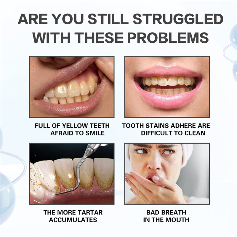 7.5% Hydroxyapatite Toothpaste Remove Yellow Tooth Stains For Sensitive Teeth~👍