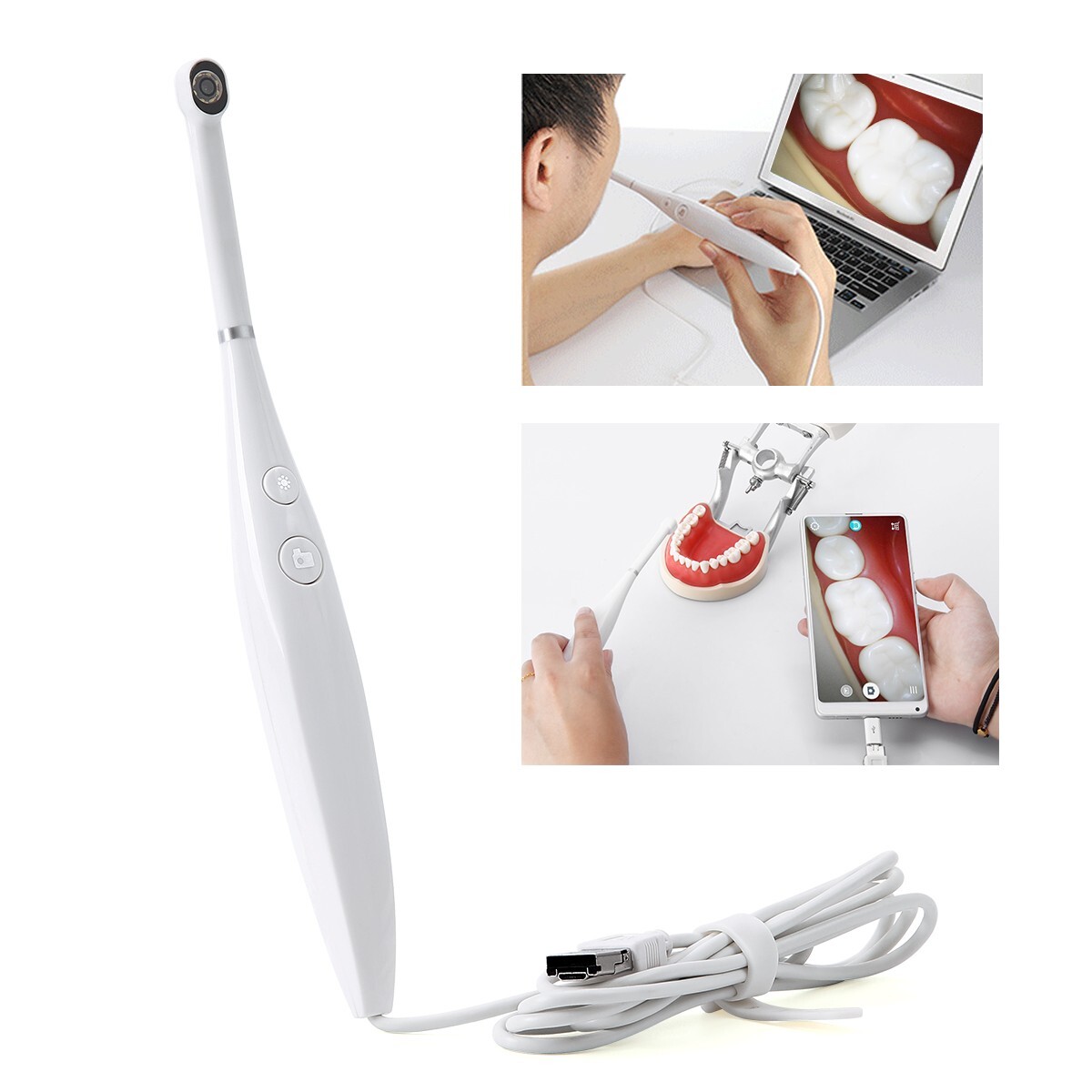 Cámara dental USB intraoral Imágenes digitales Endoscopio intra oral 8 Cámara HD