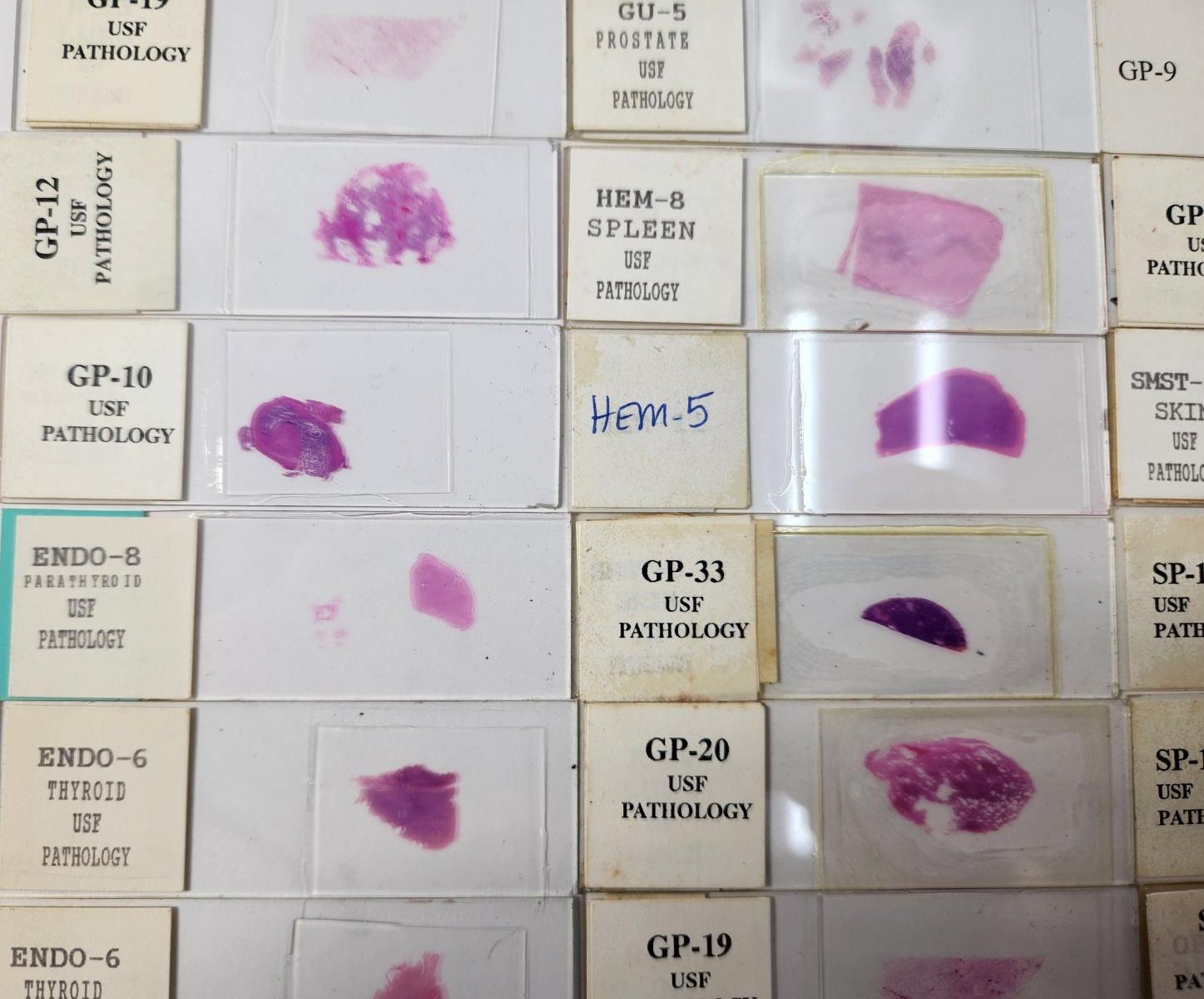 Lot Of 50 Vintage University Prepared Pathology Microscope Slides - Slides Only