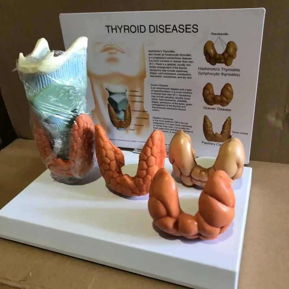 Thyroid Disease Lesion Anatomical Model Thyroid Anatomy Teaching Mode