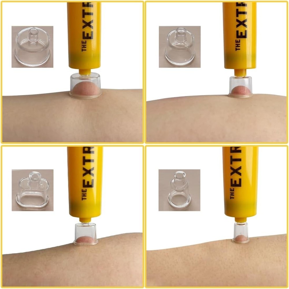 Snake Bite Kit for Humans Extractor Pump Tool First Aid for Safe Fast Emergency