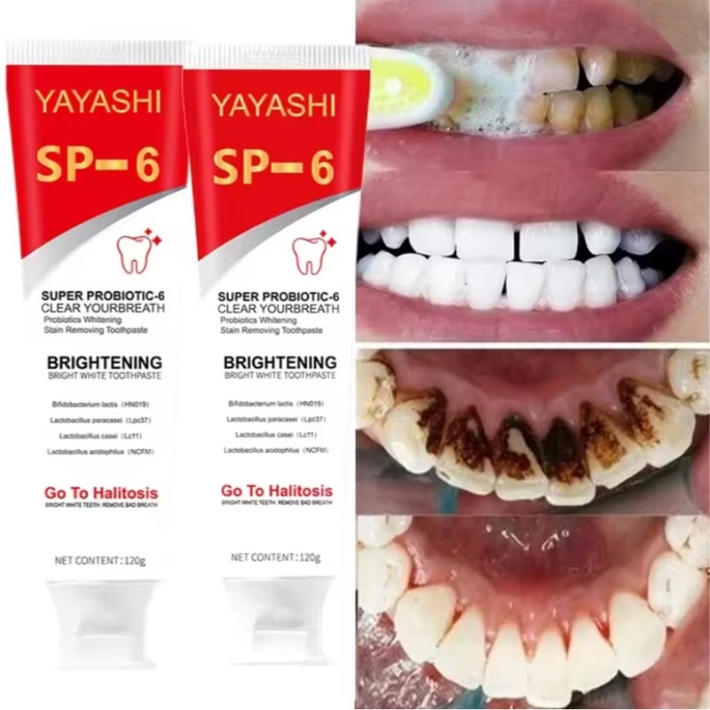 4Pcs Super Probiotic SP-6 Toothpaste, Probiotics Bright White Toothpaste, Sp 6