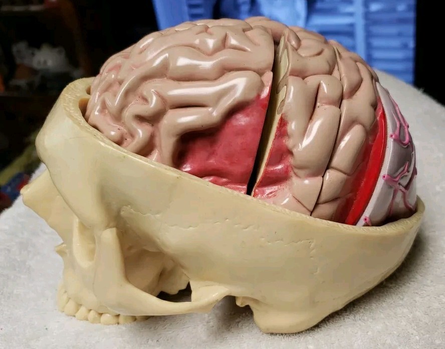GPI Brain/ Partial Skull Model