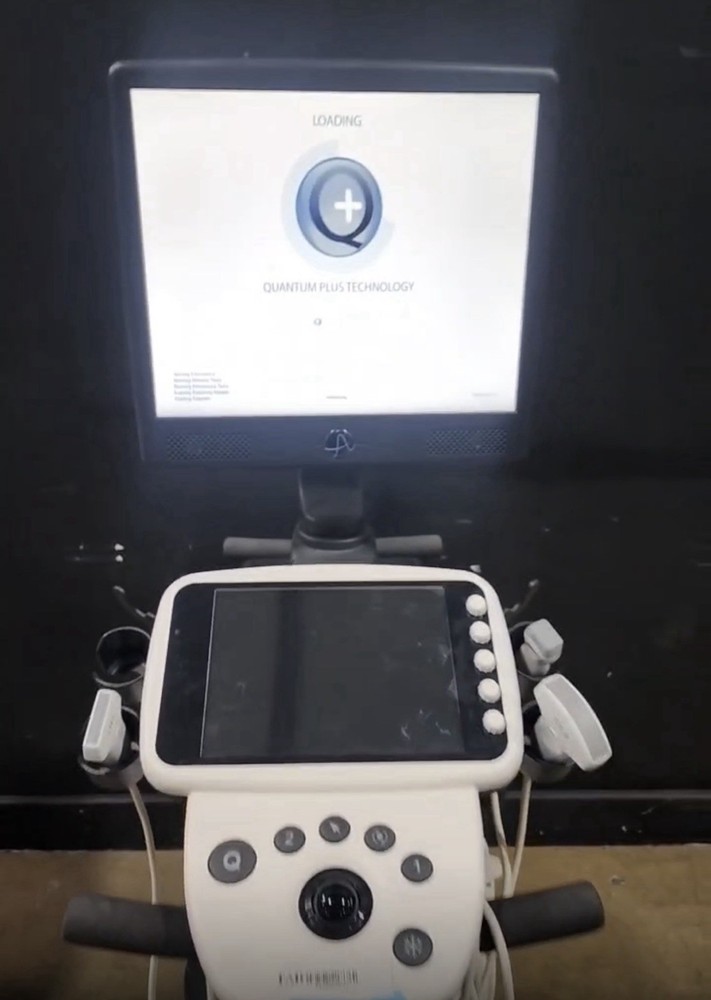 UltraSonix Sonix Touch Ultrasound