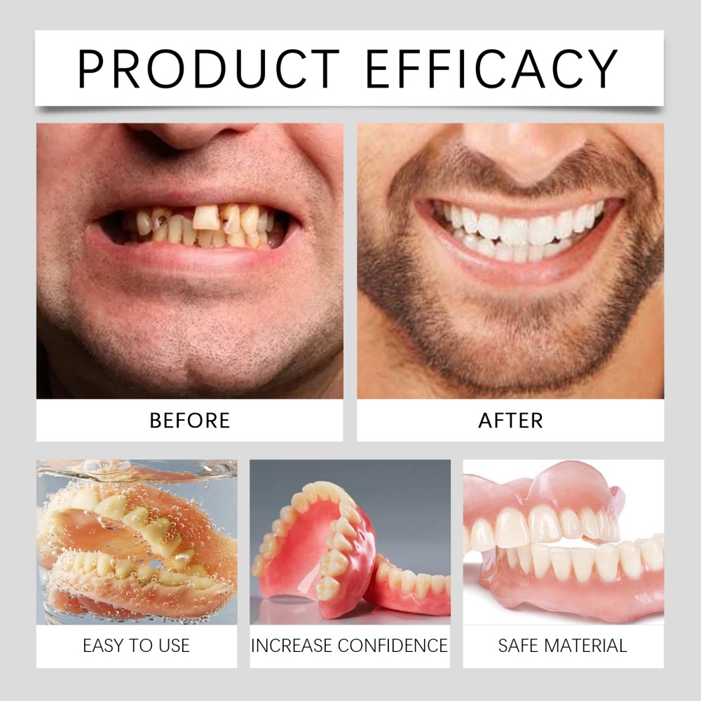 Full Denture Set For Men And Women Upper And Lower Denture False Teeth Personal