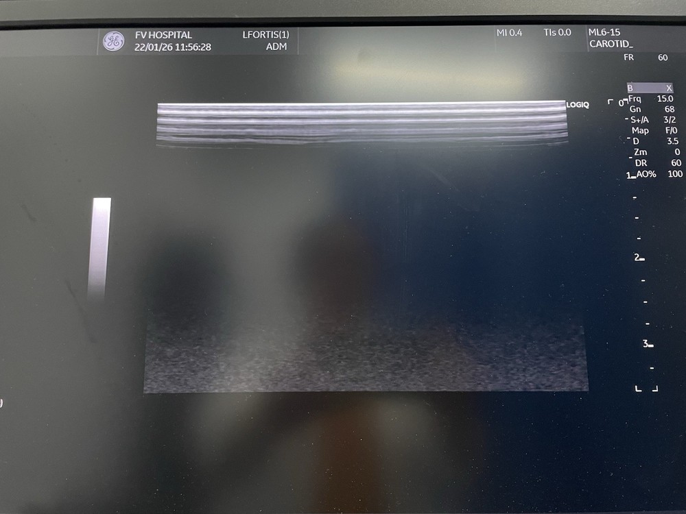 GE Ultrasound probe Linear ML6-15D