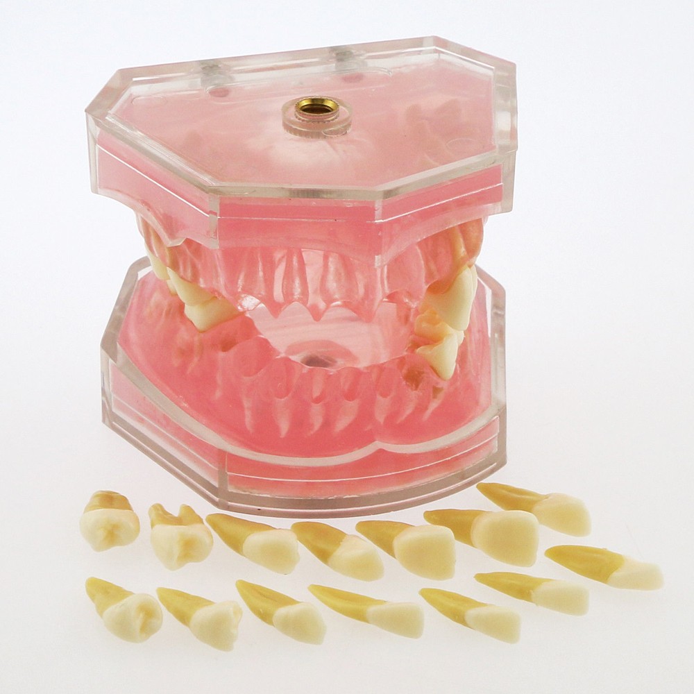 Dental Standard TYPODONT Orthodontic Teeth Model with 28 Removeable Teeth
