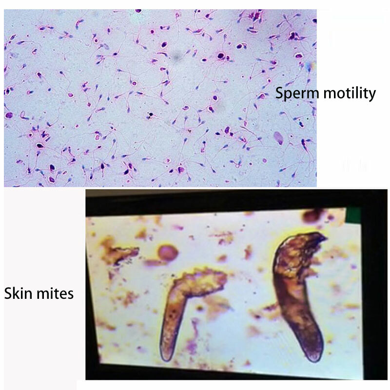 7″ Screen 40X-2000X Biological Microscope Sperm Locust Blood Test Microsocpe