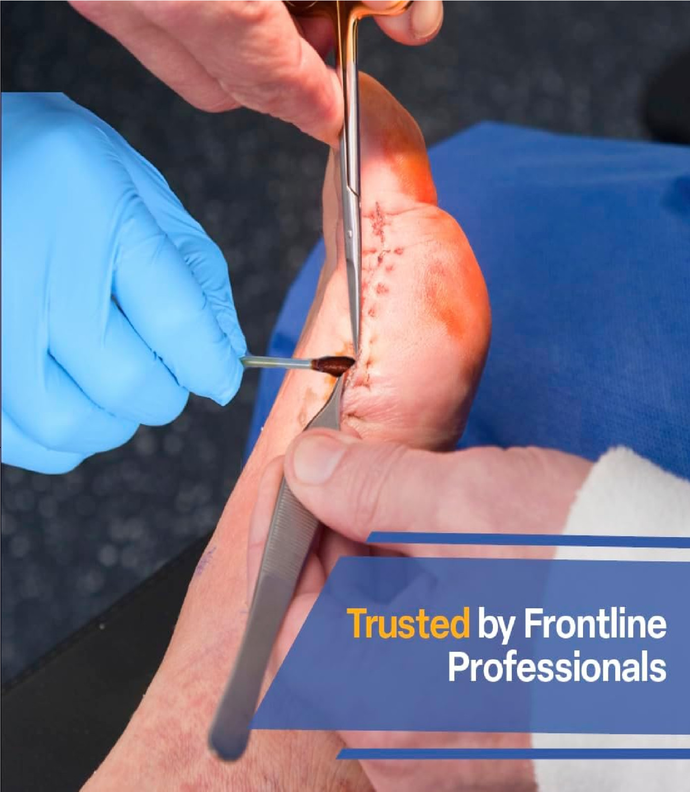 FrontLine Povidone Iodine Swabs, Antiseptic Swabsticks, Iodine SolutionBox of 50