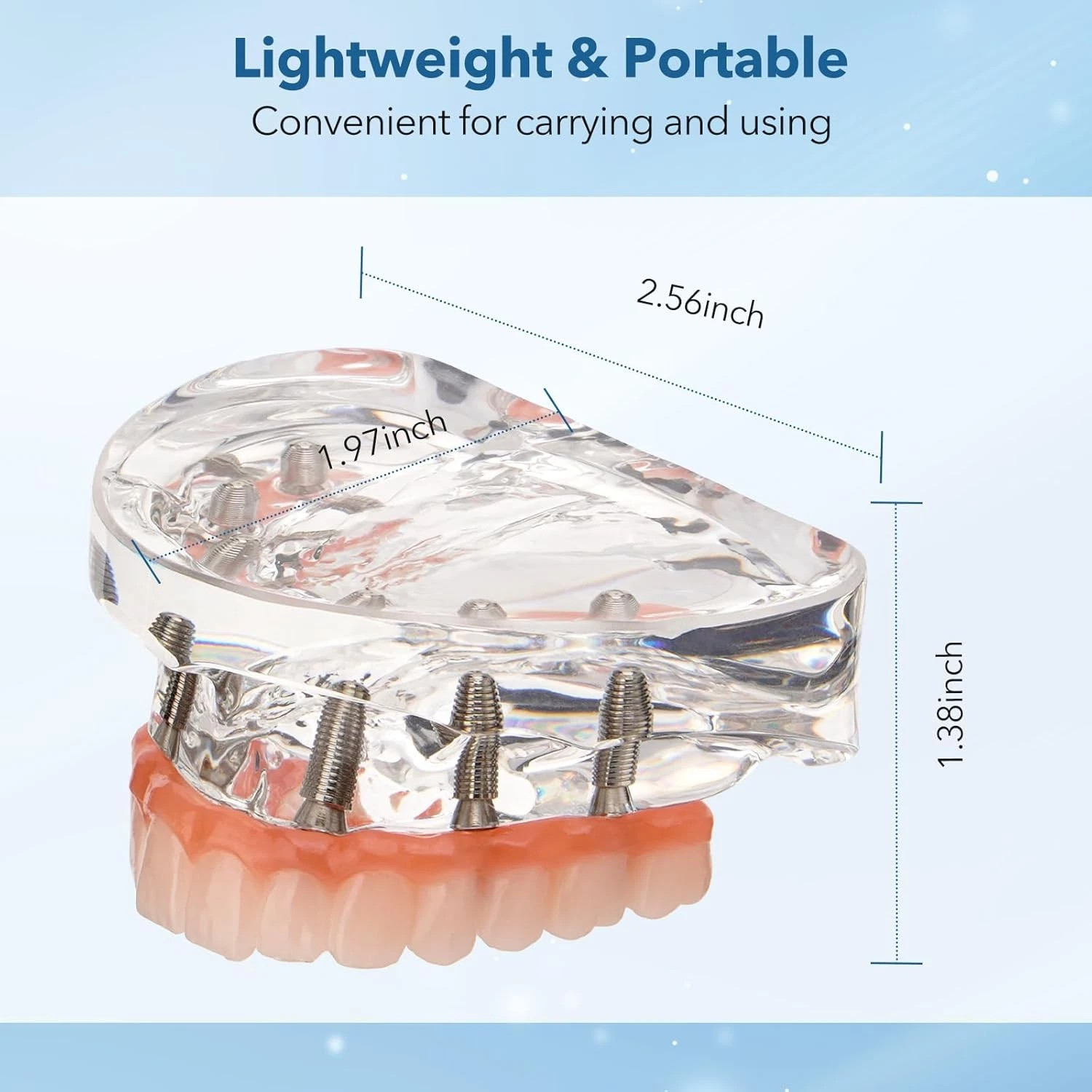 Dental Implant Restoration Model Upper Jaw 6 Screws Post Core Bridges M6001-2 US
