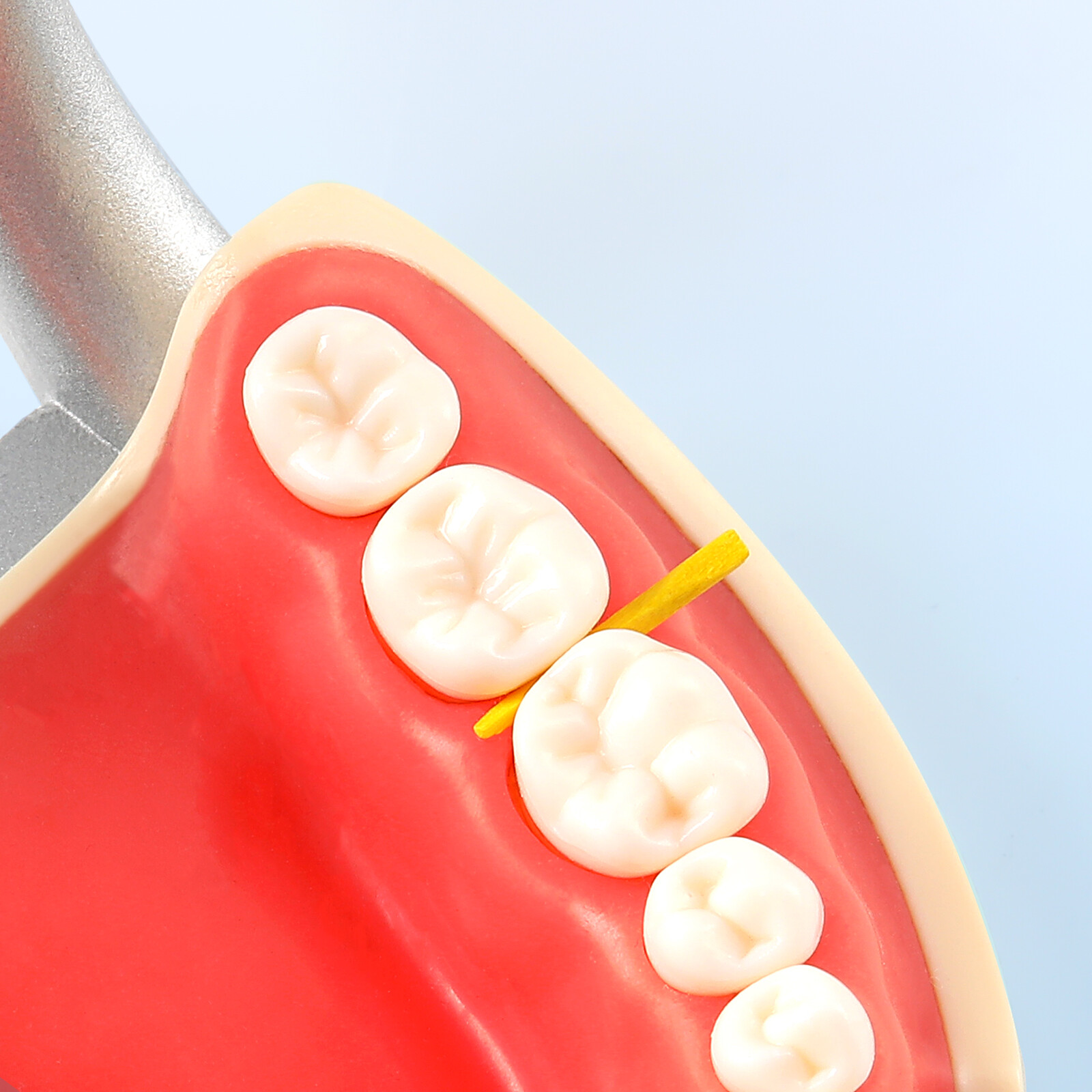 100/Box JMU Dental Wooden Interdental Wedges Contoured Matrices Wedges Tooth Gap