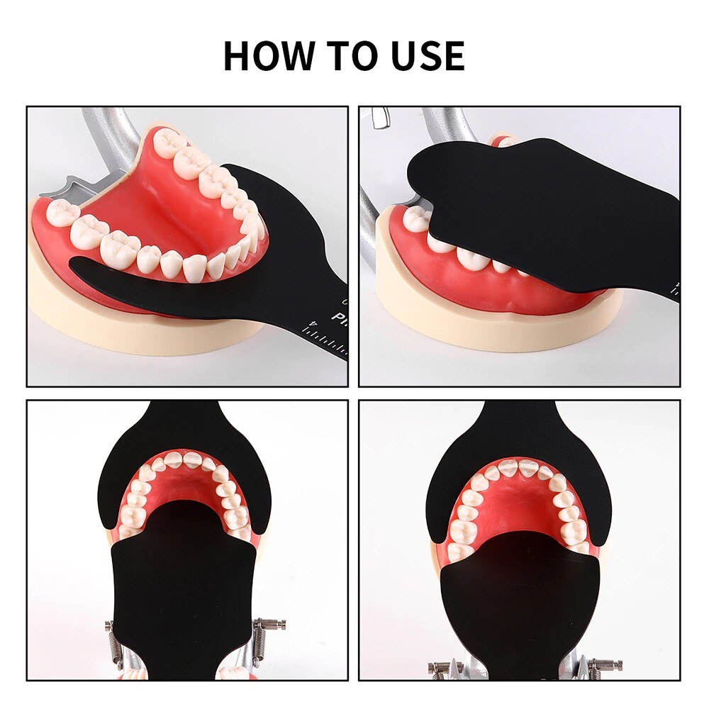 dental orthodontic photography