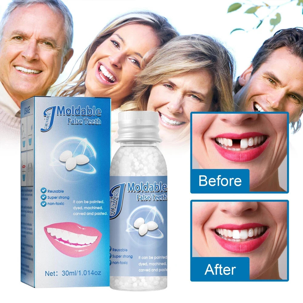 Resin False Teeth Solid Glue Temporary Tooth Gap Filler Moldable Repair
