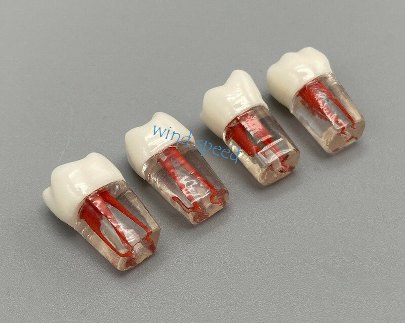 100pc Dental Root Canal Teeth Study Practice Model Endodontic RCT Endo Pulp File