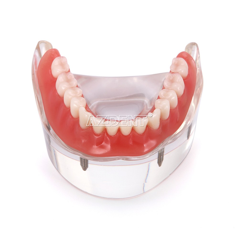 Dental Oral Study Teach Standard Typodont Tissue Decomposition Teaching Model