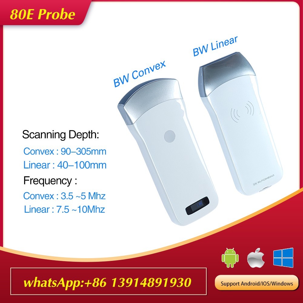 Wireless Ultrasound Probe 80Elements Scanner Machine Support iOS Android Windows