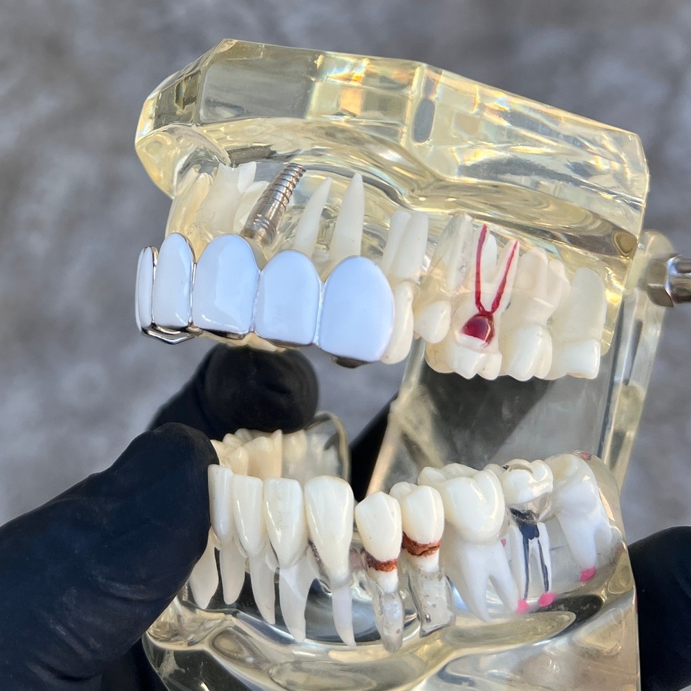 Real Solid 925 Sterling Silver White Enamel Grillz Rapper Grill Six Top Teeth